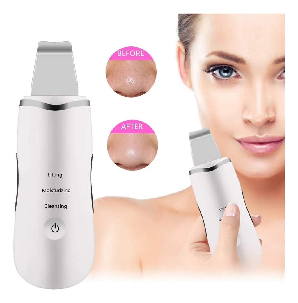 Peeling Facial Vibración Pro — Elimina Impurezas y Renueva Tu Piel en Minutos