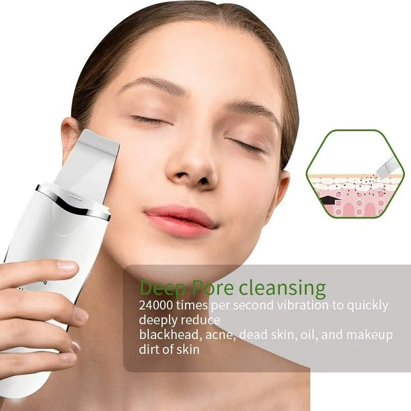 Peeling Facial Vibración Pro — Elimina Impurezas y Renueva Tu Piel en Minutos